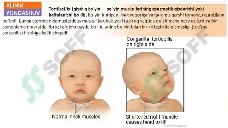 Bo’yin uchburchaklari va suyakalari, Bo’yin mushaklari. 7