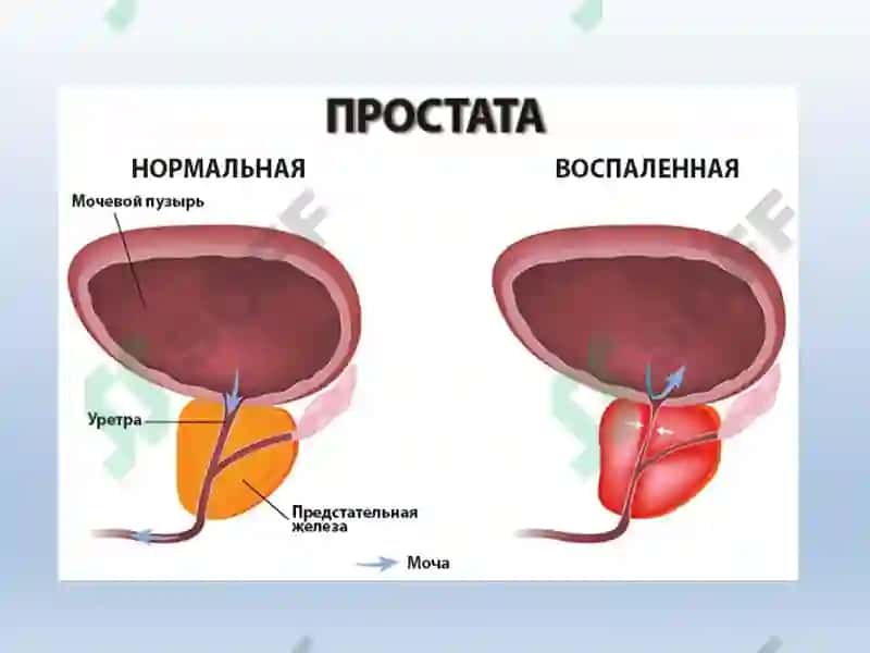 ERKAKLAR TANOSIL A`ZOLARI, AYOLLAR TANOSIL A`ZOLARI 7