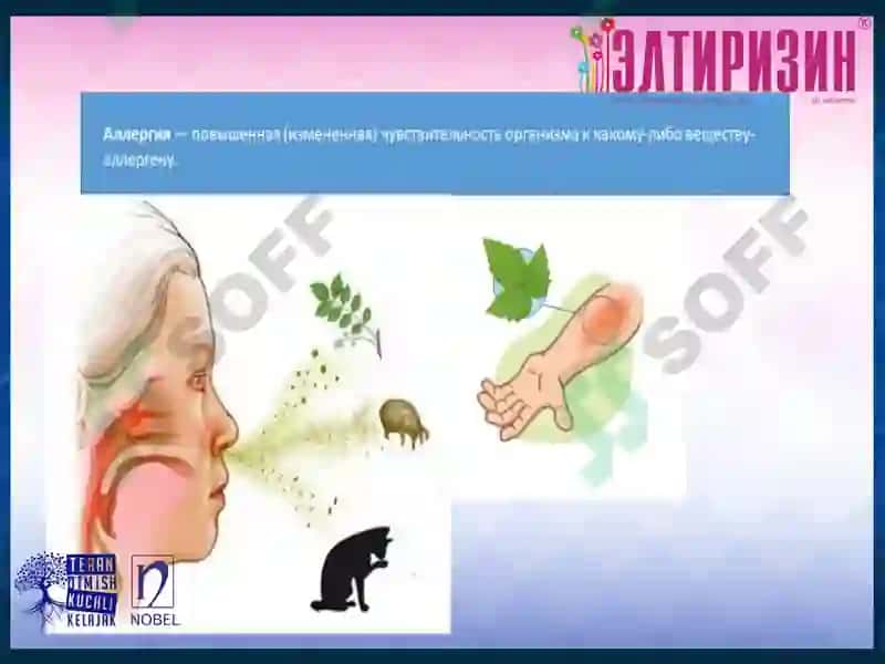 Лекция на тему: «Современные подходы диагностики и профилактики астмы» 7