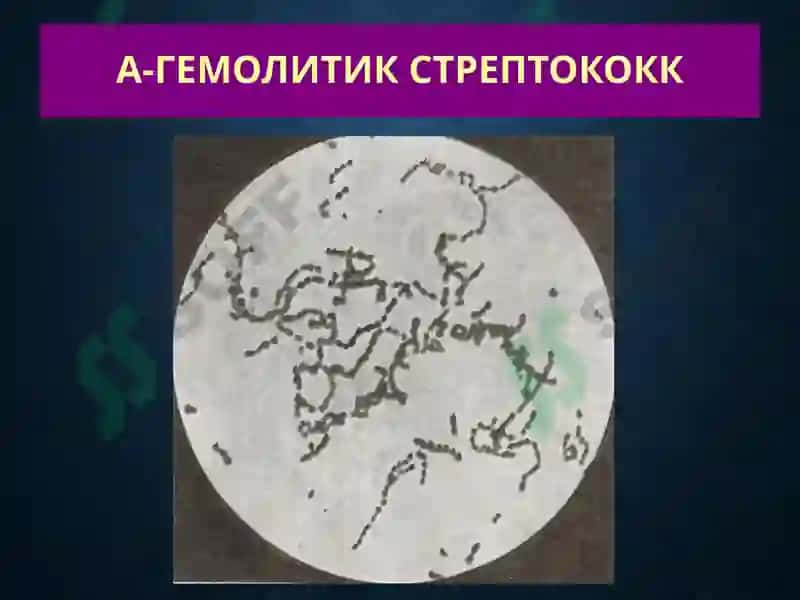 Терининг йирингли касалликлари-пиодермитлар 7