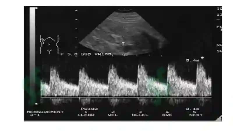 Buyrak va siydik yo'llari normal radiologik anatomiyasi tekshiruv usullari 7