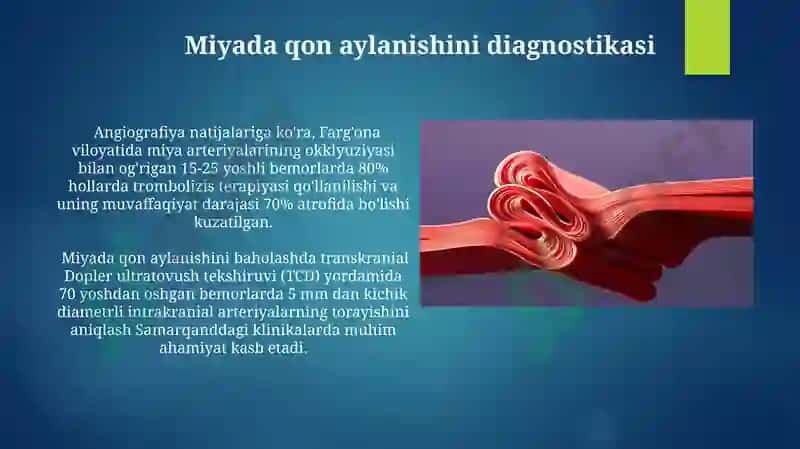 MRT angiografiyasi 7
