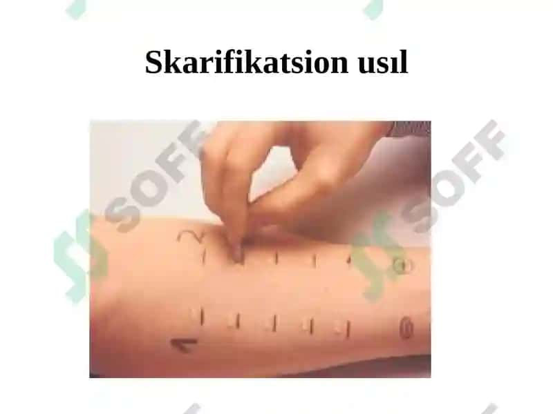 Allergiyalıq keselliklerdi diagnozlaw ushın klinik hám laboratoriya usılları 7