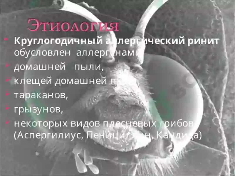 Аллергический ринит 7