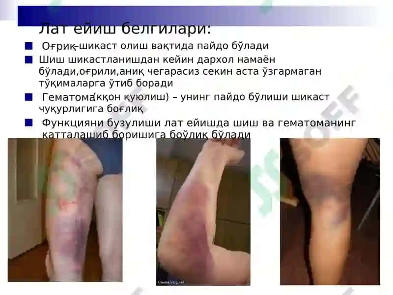 Шикастланишлар 7