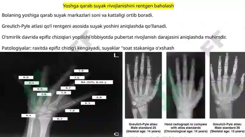 Rentgen_nurlarini_o'rganish_tarixi,_suyak_va_bo'g'imlar_rivojlanishini 8