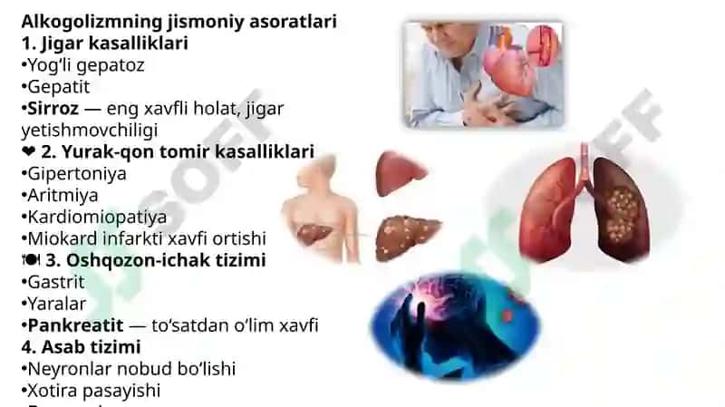Etil spirti. Alkogolizm va uning asoratlari. 8