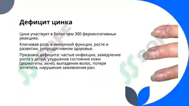Микроэлементозы. Избыток фтора, кальция. Заболевания, вызванные дефицитом микроэлементов, и их профилактика 8