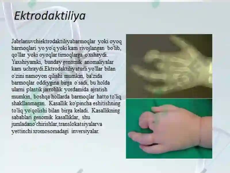 Mutatsiya, DNK reparatsiyasi , korssingover va jinsiy konversiyaning molekulyar mexanizmlari 8