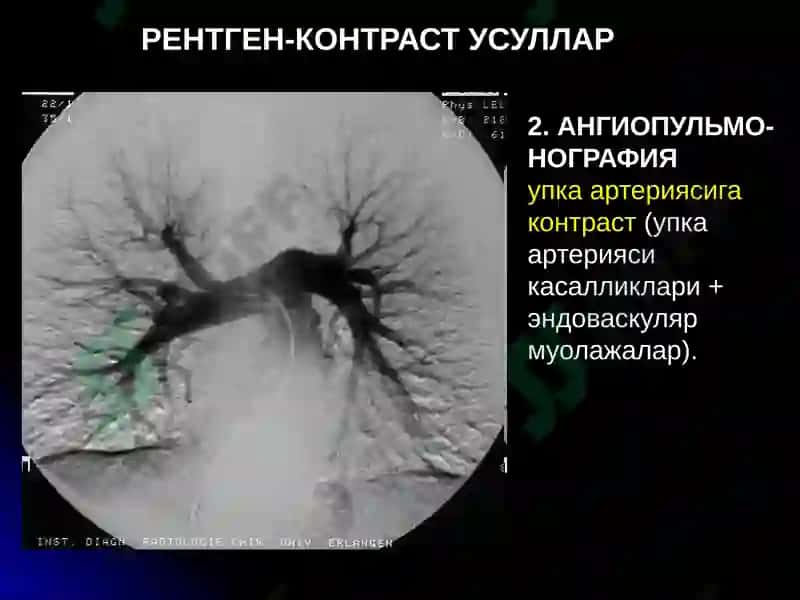 УПКА КАСАЛЛИКЛАРИНИНГ НУР ТАШХИСИ 8