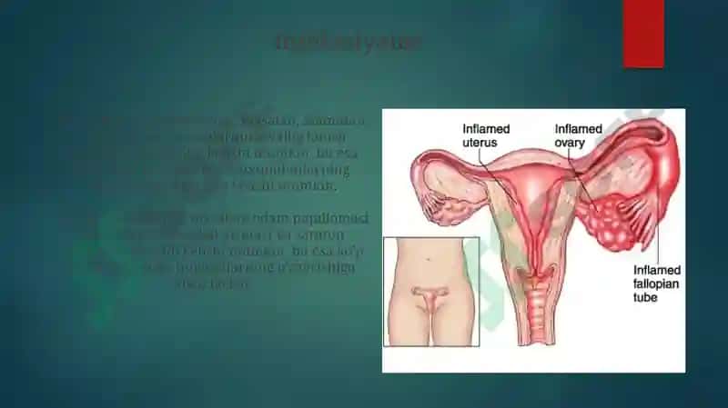 Ayollarjinsiytizima'zolariyallig'lanishjarayoninipatofiziologiyasi 8