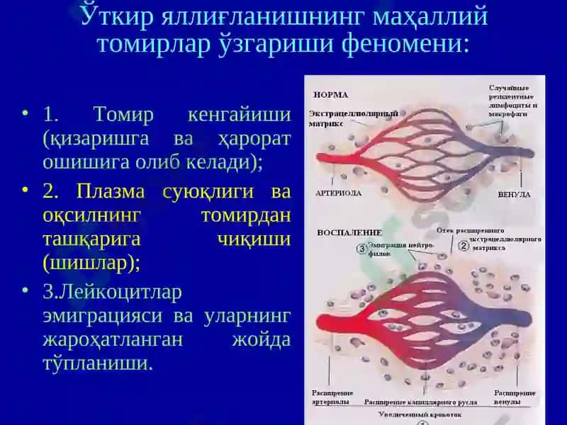 Яллиғланиш -INFLAMMATION 8