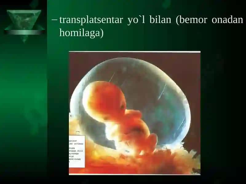 Virusli gepatit kasalligida bemor bolaga hamshiralik parvarishi 8