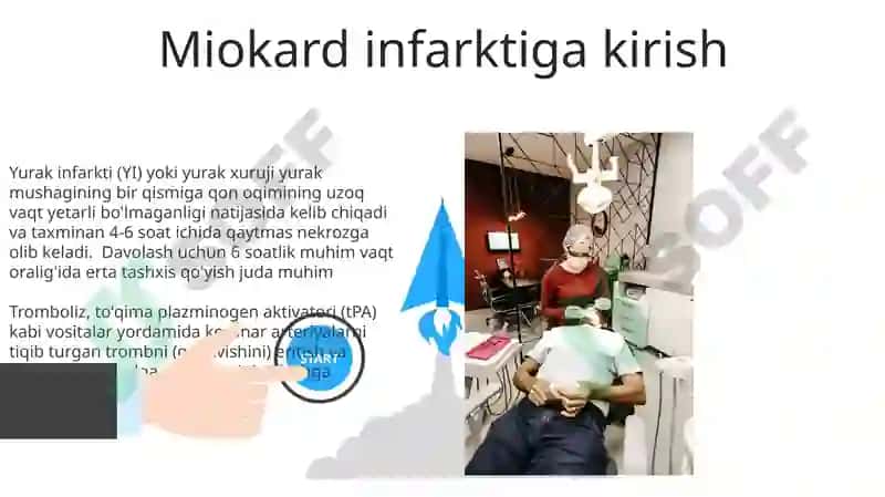 Trombolitik vositalar va mexanizmlar 8