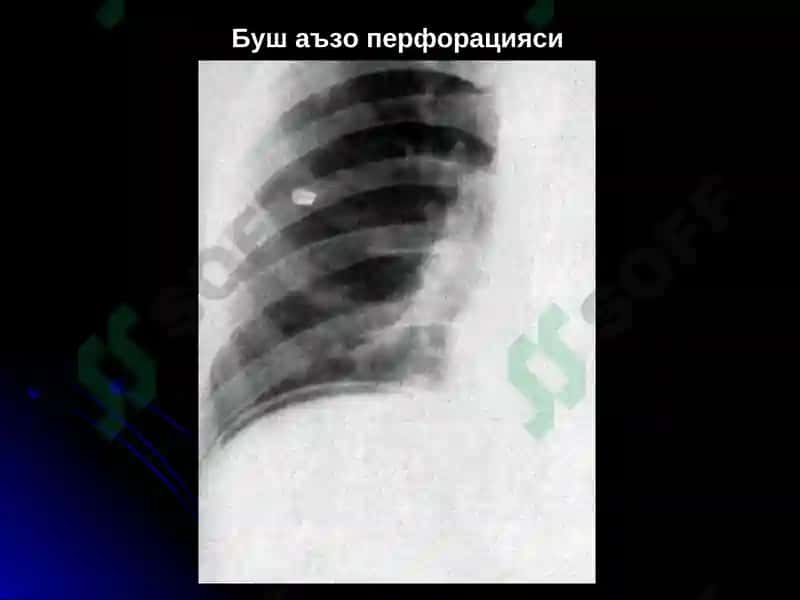 ОШКОЗОН-ИЧАК КАСАЛЛИКЛАРИ НУР ТАШХИСИ 8