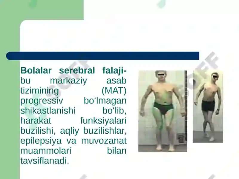 Tayanch-harakat apparatida nuqsonlari bо‘lgan bolalar rivojlanishining o‘ziga xos xususiyatlari 8