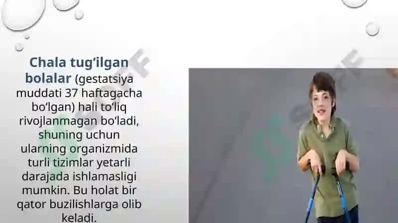 Tug’ma Anomaliyalar. Chala tug’ilganlardagi buzilishlar 8
