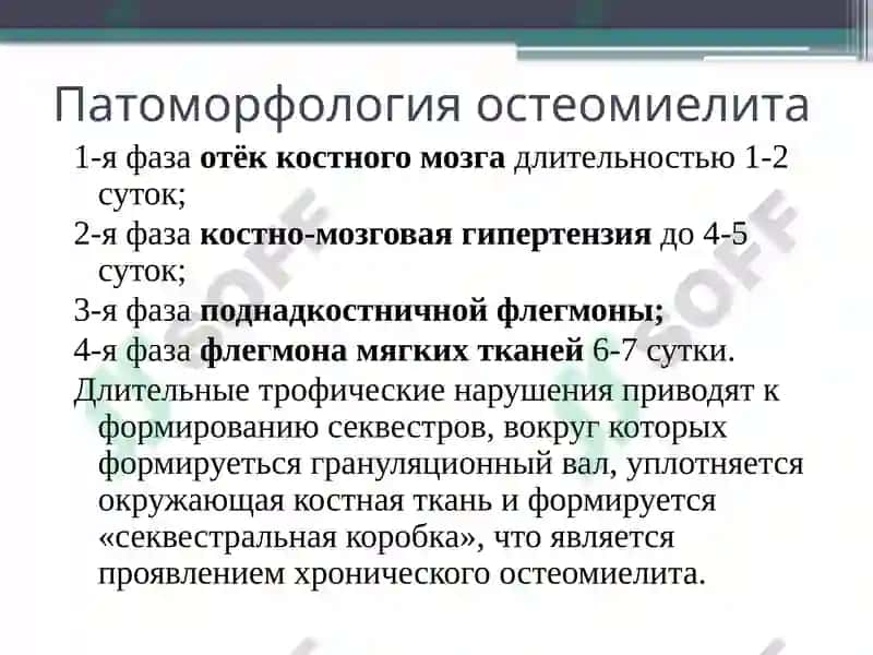 Острый гематогенный остеомиелит у детей 8