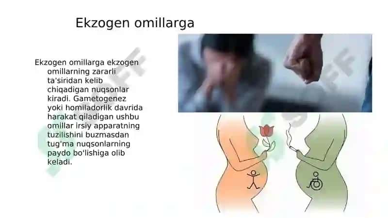 Bosh miyya va orqa miyya tug'ma rivojlanish nuqsonlari 8