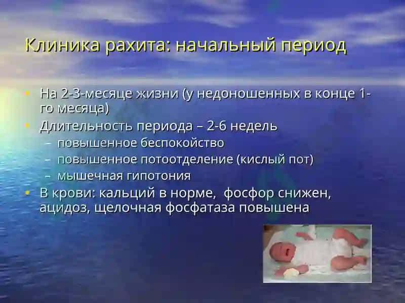 Рахит 8