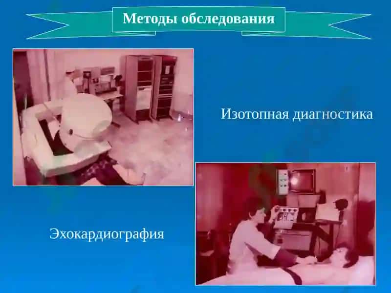 Врожденные пороки сердца 8