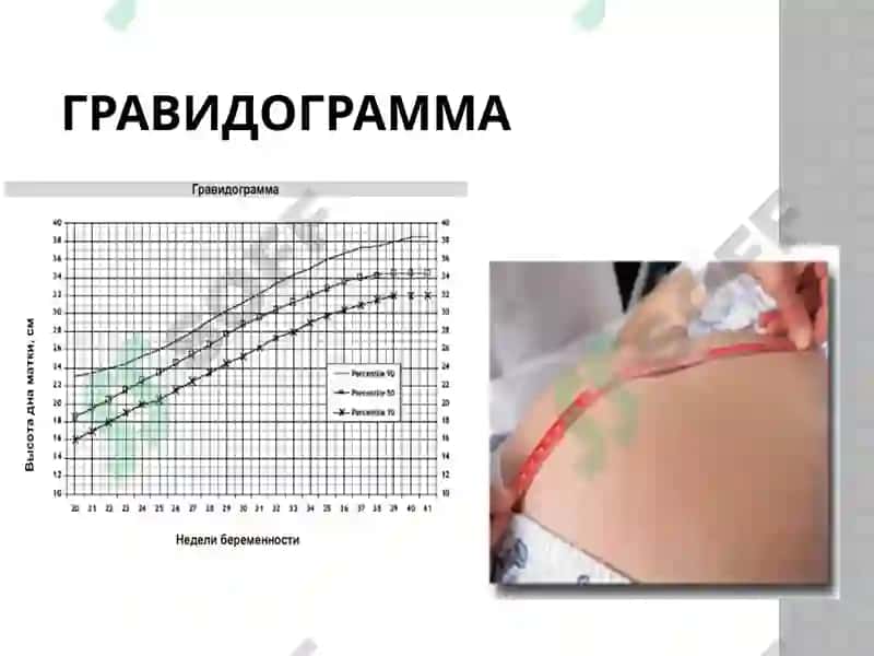 Физиологик ҳомиладорликда аёлларни олиб бориш ва текширув усуллари 8