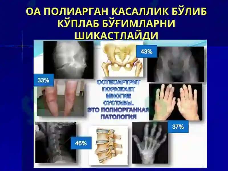 Буғим синдромини таққослама ташхиси ва умумий амалиёт шифокори тактикаси 8