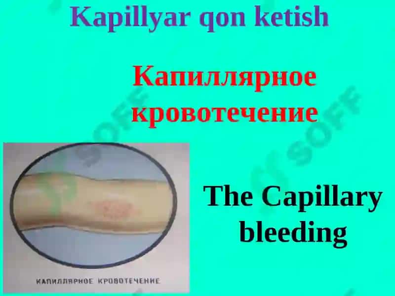 Qon ketish va uni to‘xtatish usullari 8