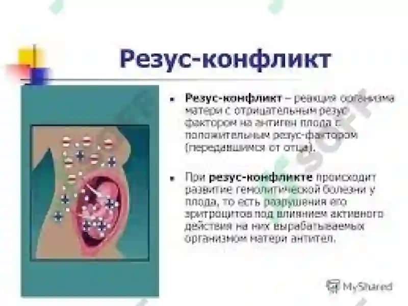 Резус фактор в акушерстве. иммуноконфликтная беременность: Гемолитическая болезнь плода 8