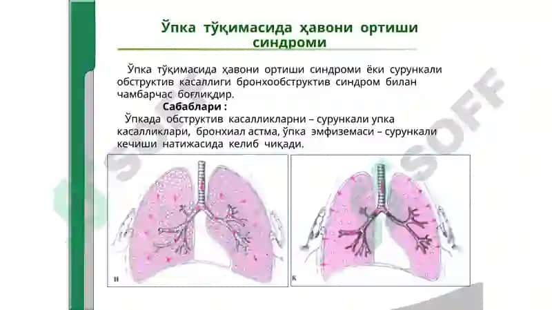 НАФАС ОРГАНЛАРИ КАСАЛЛИКЛАРИДА АСОСИЙКЛИНИК СИНДРОМЛАР 8