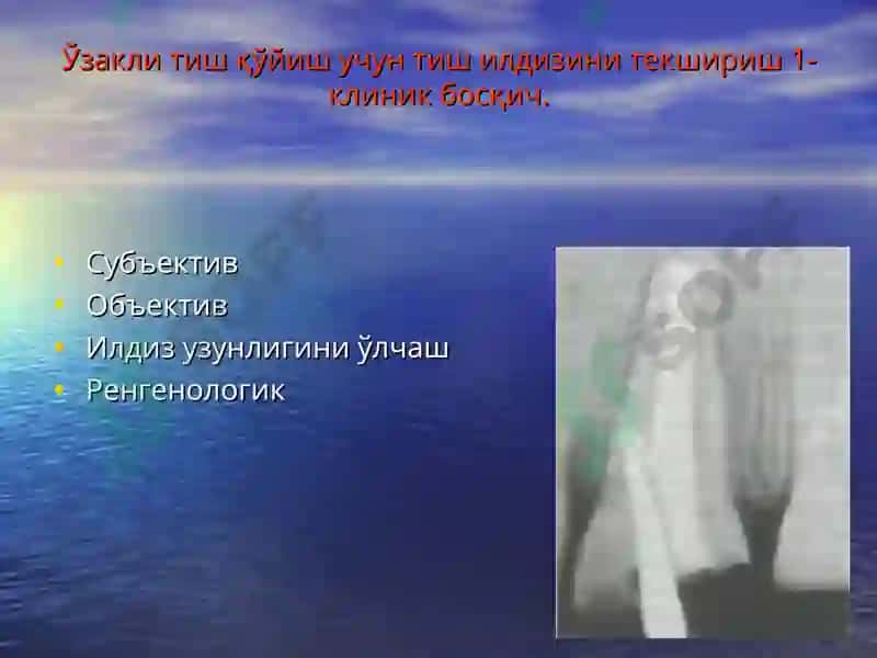 Тиш  тож  қисмининг  қисман ва  тўлиқ йўқотилганда   ўзакли конструкциялар билан тиклаш. 8
