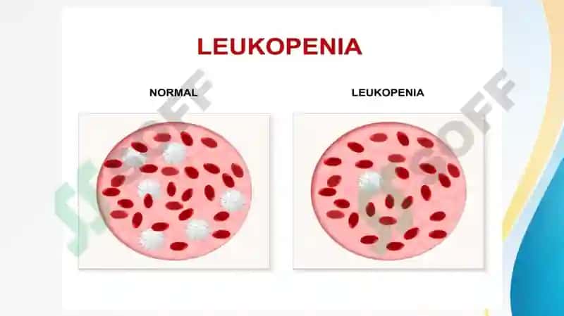 Qon patofiziologiyasi. Leykotsitoz, leykopeniya va leykomoid reaksiyalar. Leykoz va uning turlari 8