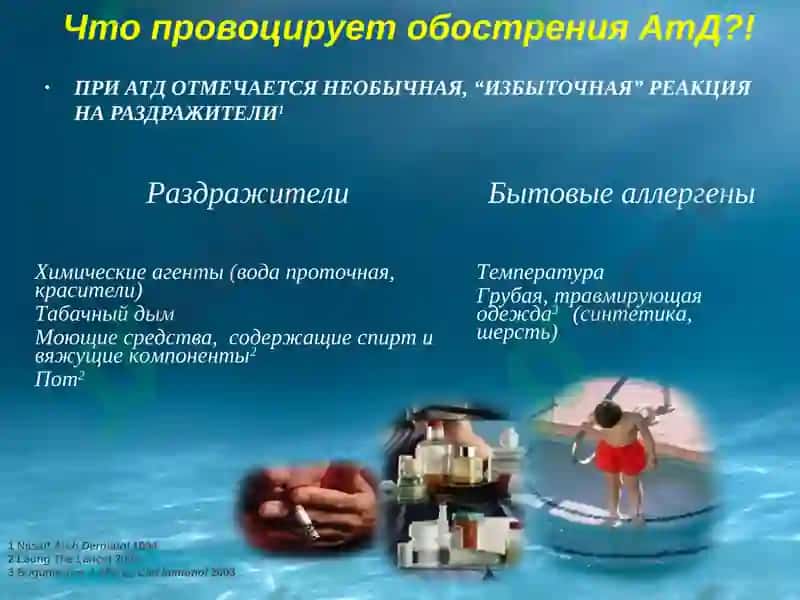 Atopik dermatit 8
