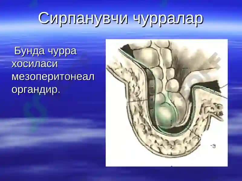 Корин олд девори касаликлари корин олди мускуллари аплозияси 8