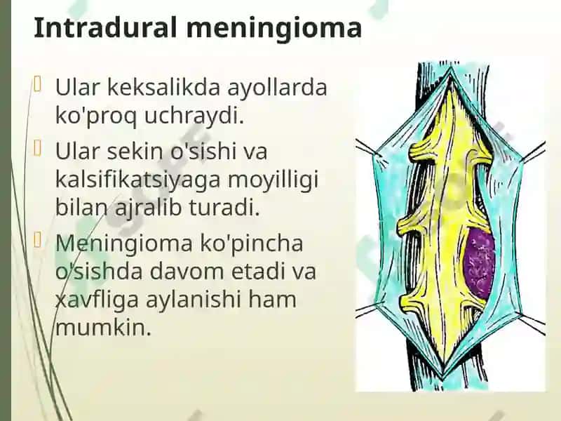 Orqa miya o’smalari 8