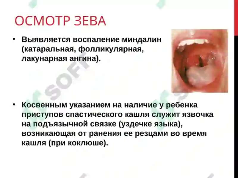 Пропедевтика детских болезней 8