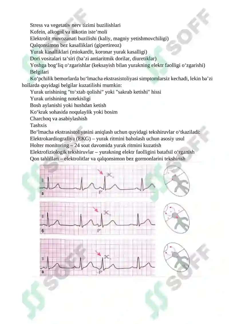 Yurak qo'zg'aluvchanligi buzilishi Patofiziologiyasi 8