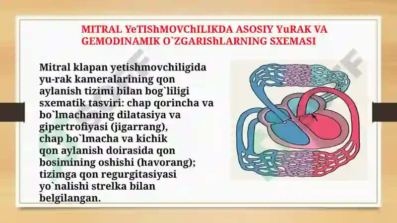 Mitral klapan nuqsonlari 8