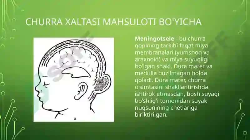 TUG'MA NUQSONLAR. BOLALARDA MIYA CHURRASI VA YURAK NUQSONLARI 8
