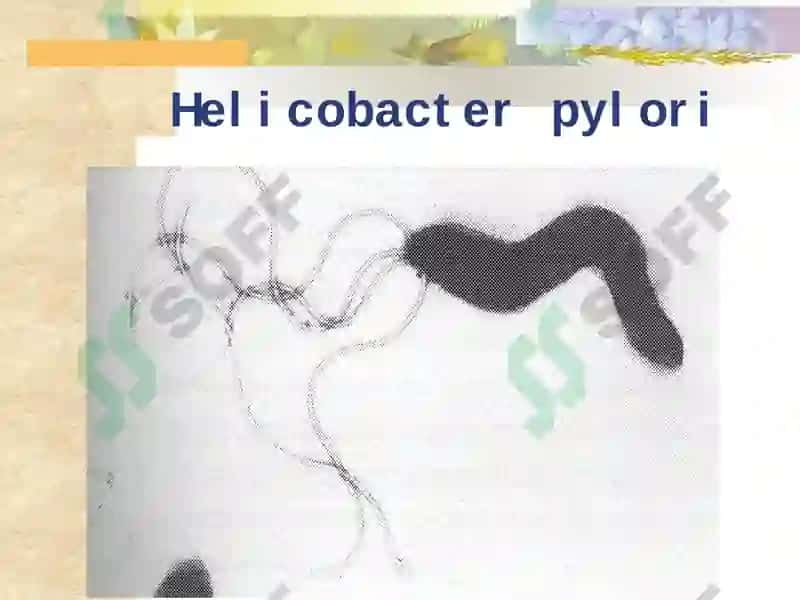 ME'DA VA O`N IKKIBARMOQLI ICHAK YARAKASALLIGI 8