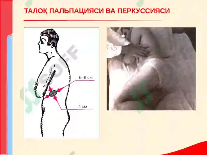 КОН ТИЗИМИ КАСАЛЛИКЛАРИ БИЛАН КАСАЛЛАНГАН БЕМОРЛАРНИ ТЕКШИРИШ. АСОСИЙ КЛИНИК СИМПТОМЛАР 8
