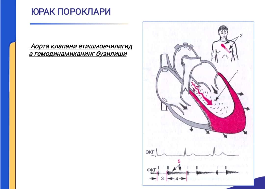 YURAK POROKLARI, AORTAL KLAPANINING YETISHMOVCHILIGI. AORTA OG`ZINING STENOZI. QON AYLANISHI YETISHMOVILIGI