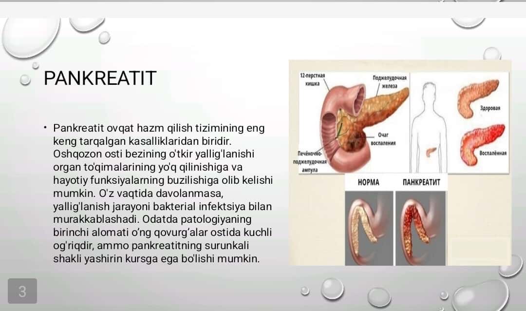 Pankreatit rivojlanishining biokimyoviy asoslari davolash va diagnostika tamoyillari, ingichka ichakda parchalanish mahsulotlari so’rilishining buzilishi(seliakiya), kron kasalligi va yarali kolit rivojlanishining biokimyoviy asoslari.