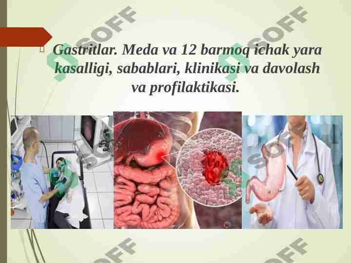Gastritlar. Me'da va 12 barmoq ichak yara kasalligi ,sabablari, klinikasi va davolash profilaktikasi