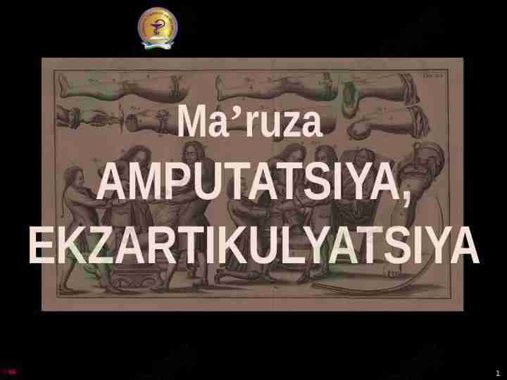 AMPUTATSIYA, EKZARTIKULYATSIYA