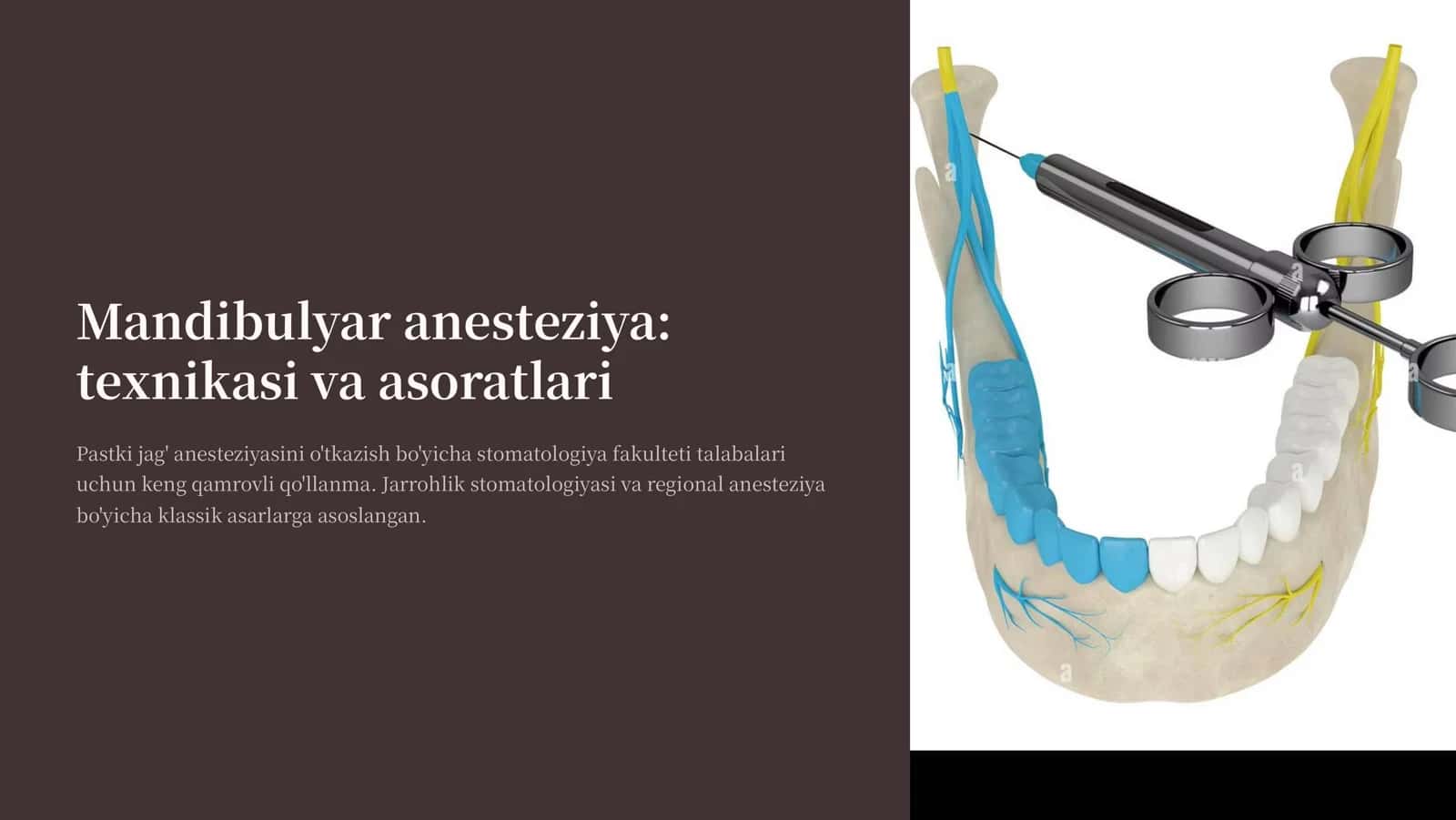 Mandibulyar anesteziya