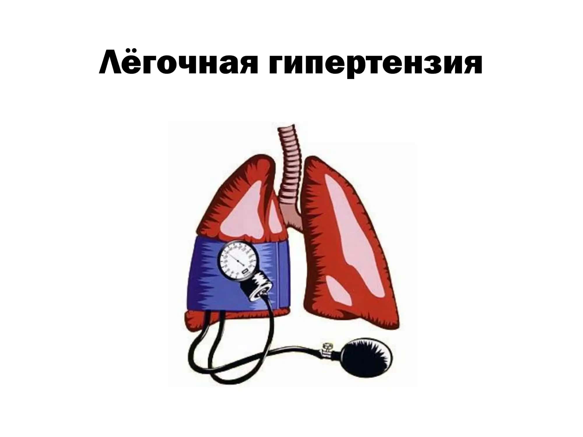 Первичная лёгочная гипертензия
