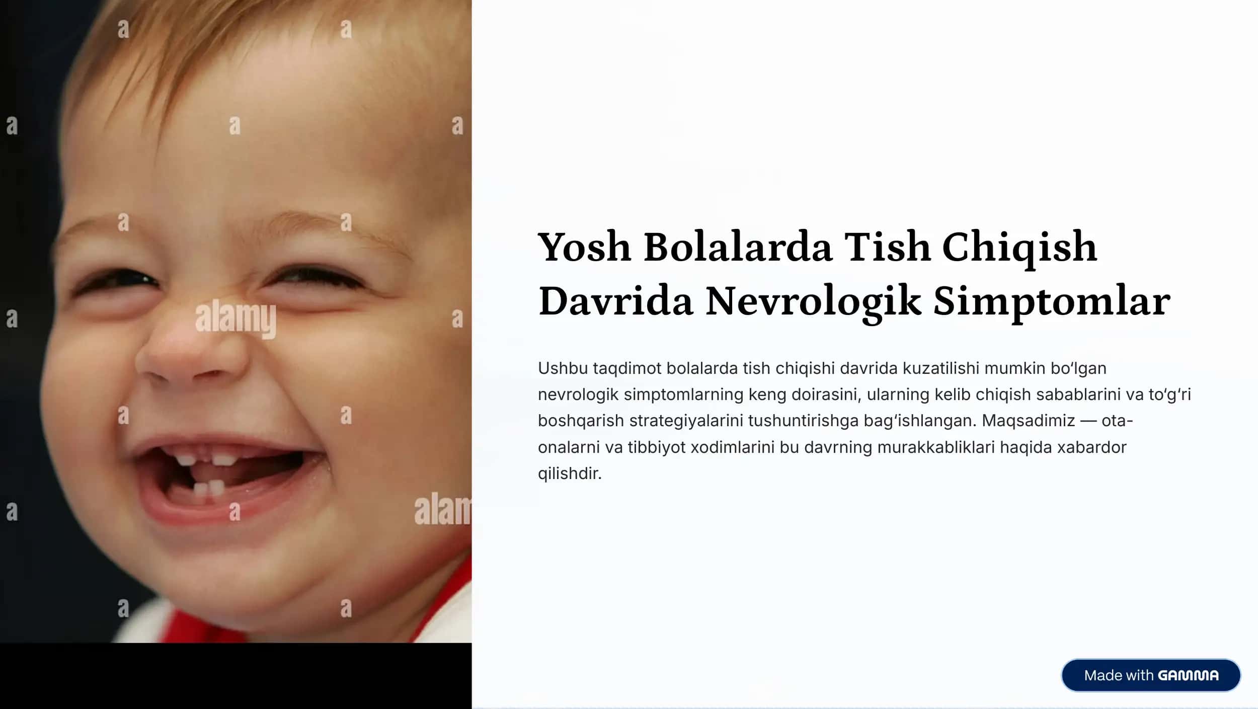 Yosh Bolalarda Tish Chiqish
Davrida Nevrologik Simptomlar