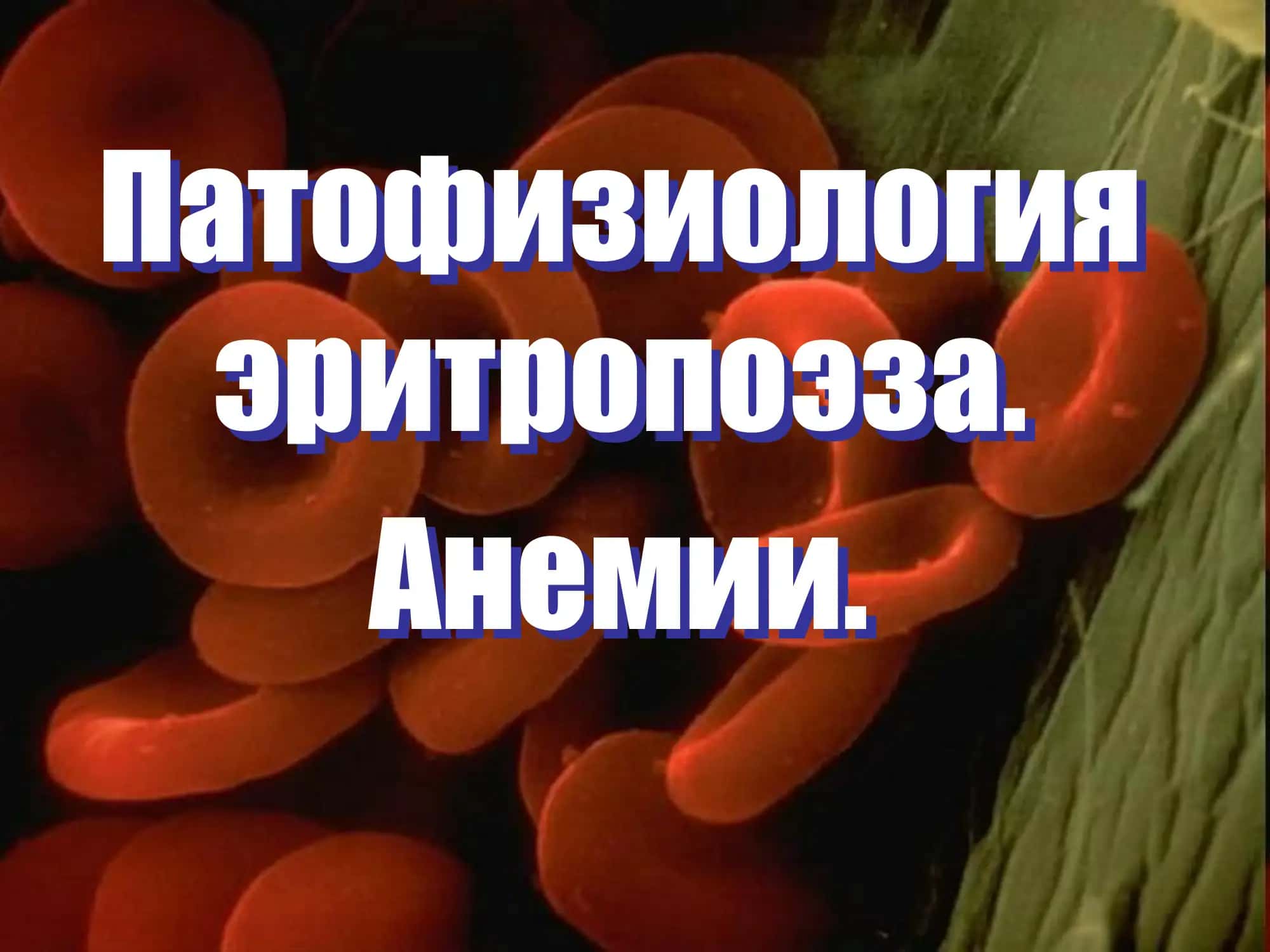 Патофизиология эритропоэза. Анемии.