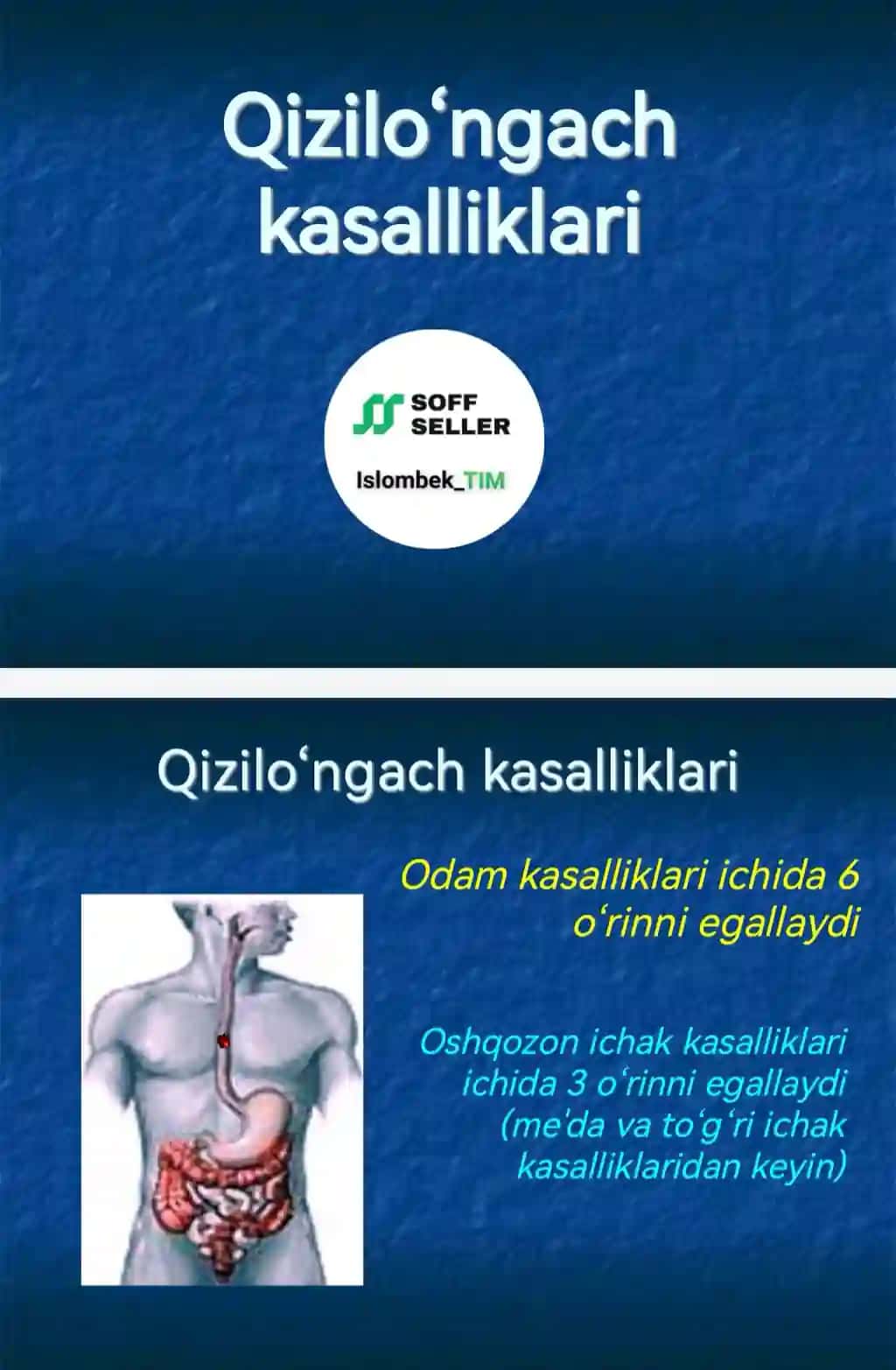Qizilo‘ngach kasalliklari